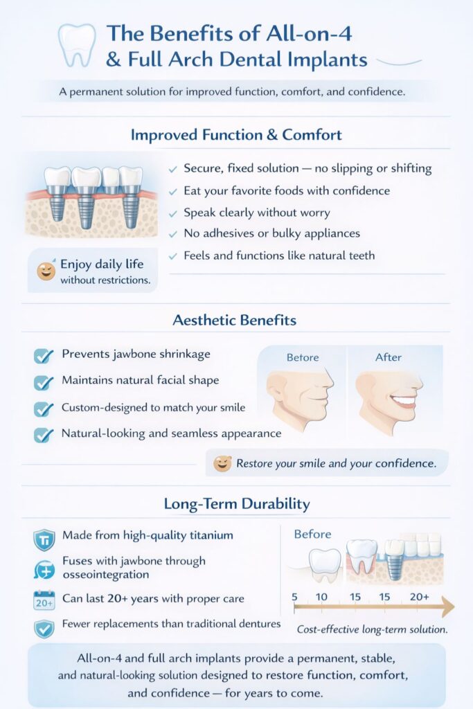 benefits of full arch implants and all-on-4 implants