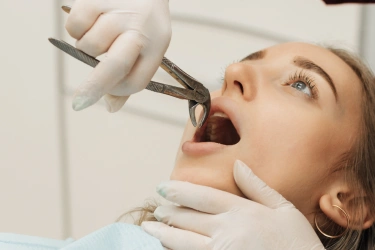 corrective jaw surgery in el monte